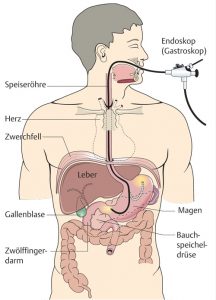 Gastroskopie Dr. Gottfried Steiner